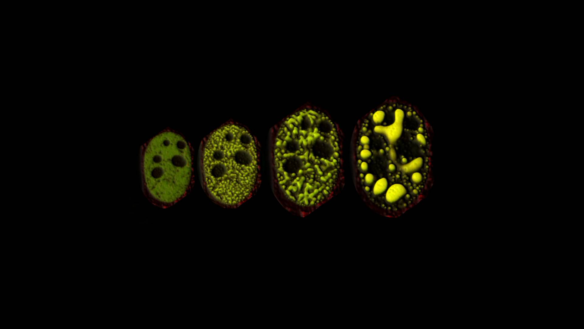 electron microscope images of membraneless organelles