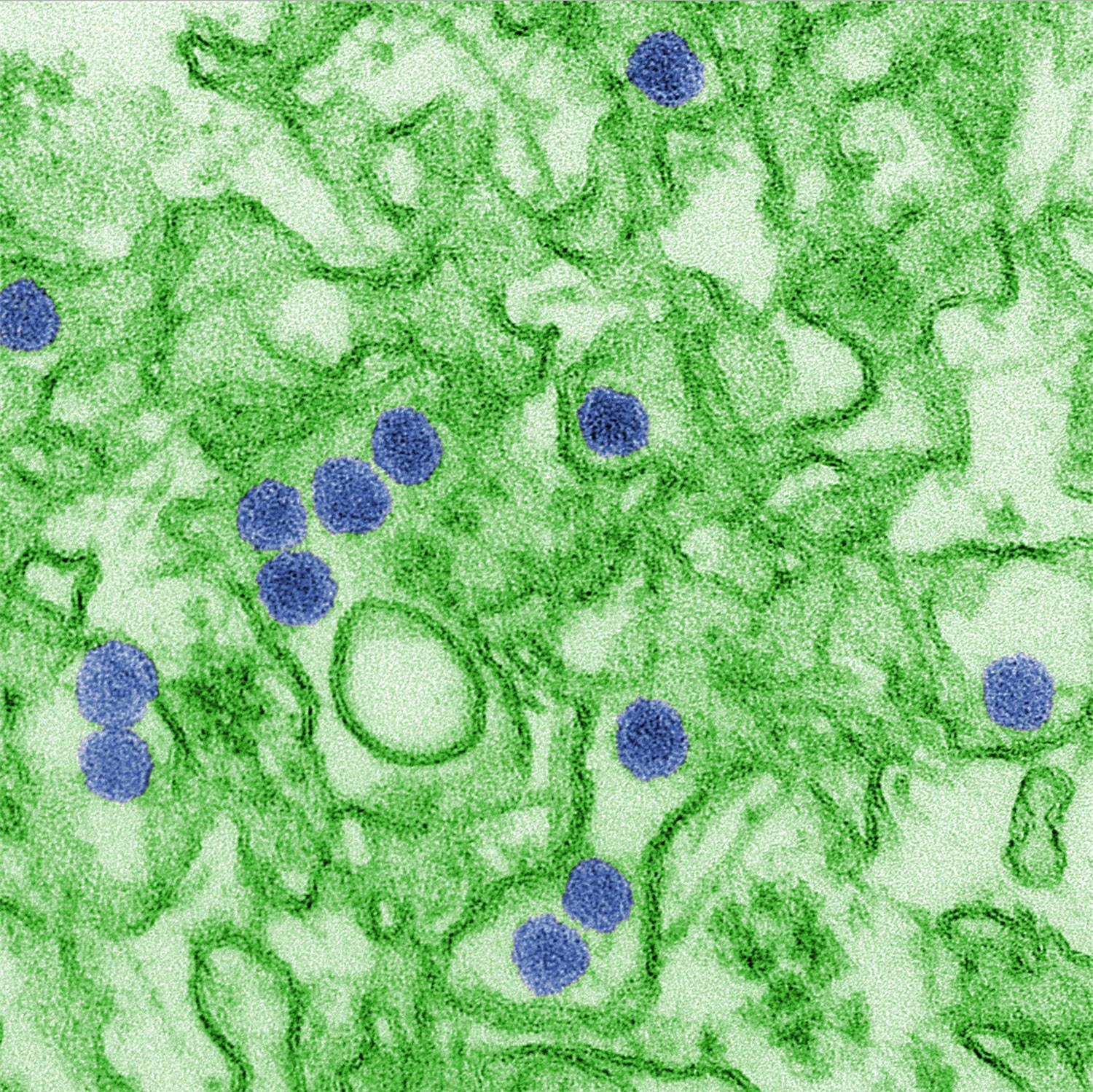 mosquito-borne Zika virus