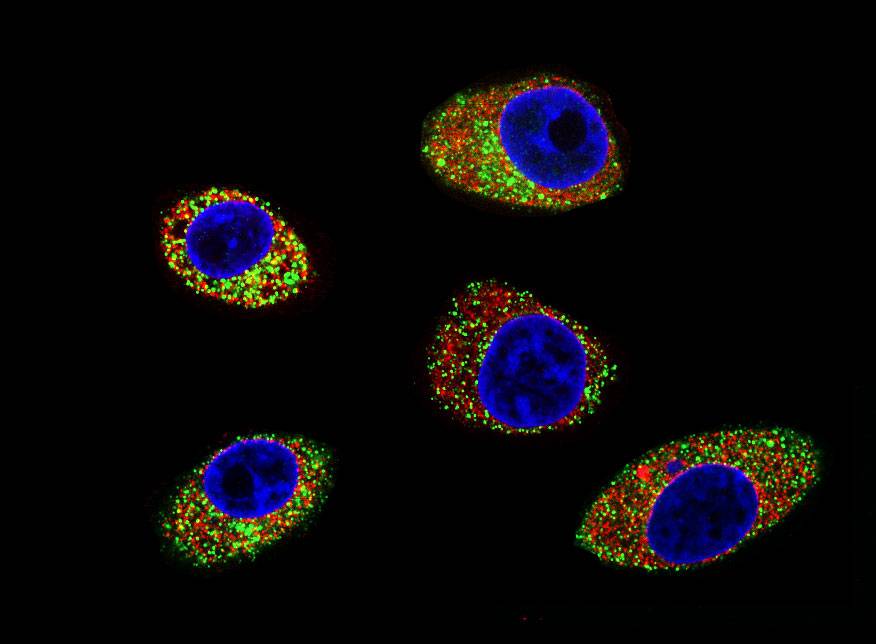 hepatitis E virus